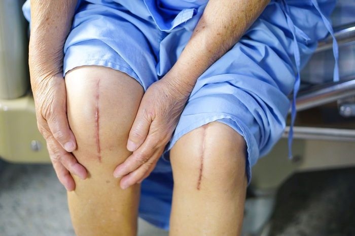Tarabichi Hip & Knees