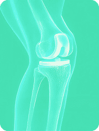 Tarabichi Hip & Knees