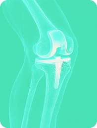 Tarabichi Hip & Knees